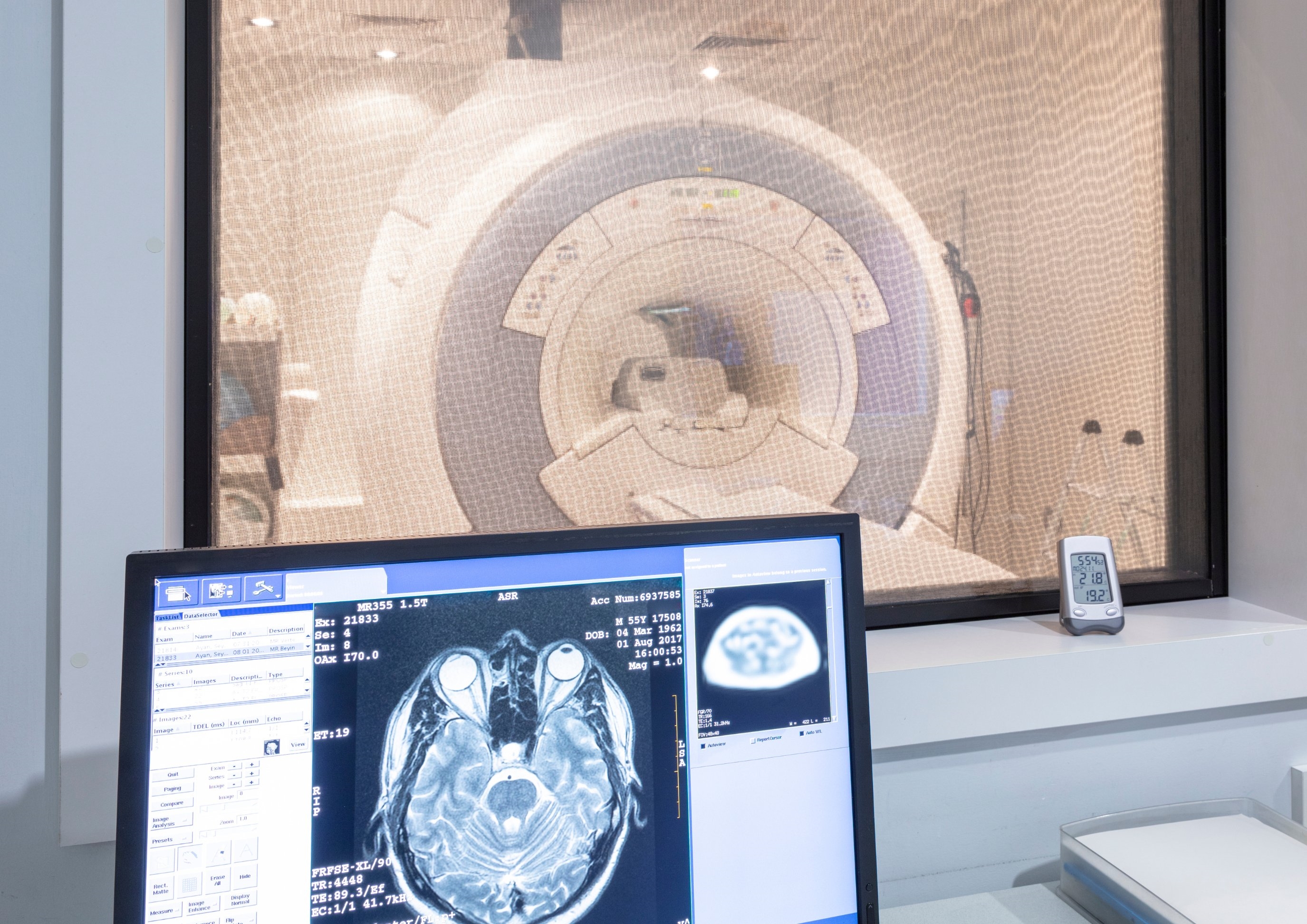 MRI brain scan MRI brain scan